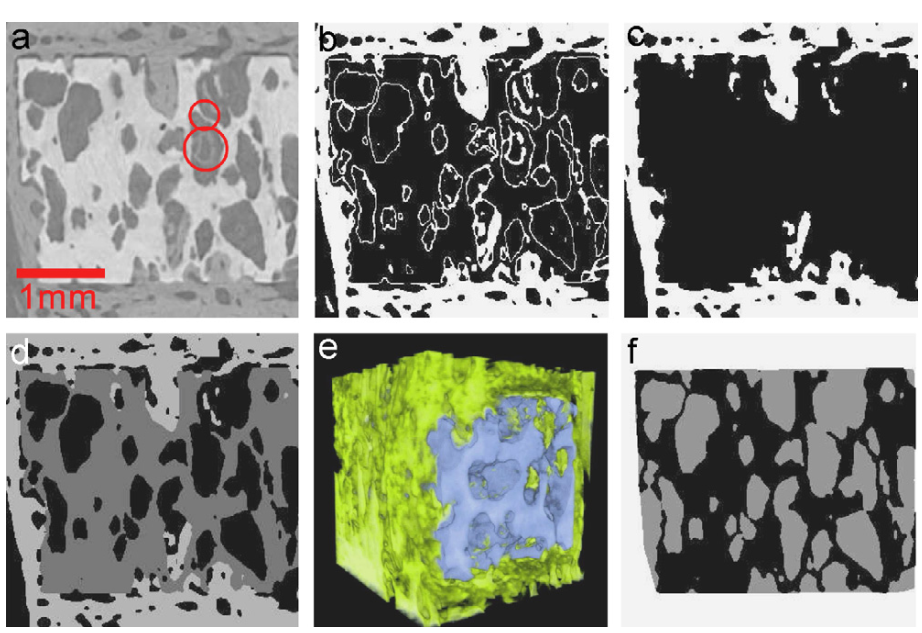 Assessment of Bone Ingrowth into Porous Biomaterials Using Micro-CT